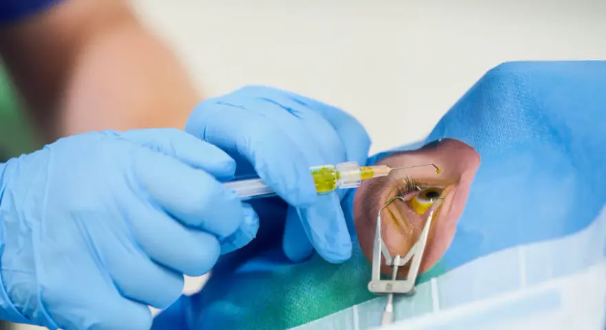 Lekarz w niebieskich rękawiczkach podaje lek do oka pacjenta. To ważny krok w procesie powrotu do pracy po witrektomii, który przywraca ostrość widzenia.