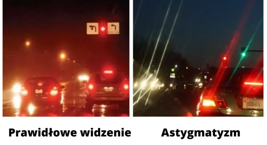 Astygmatyzm: Jak odzyskać ostre widzenie? Objawy i korekcja