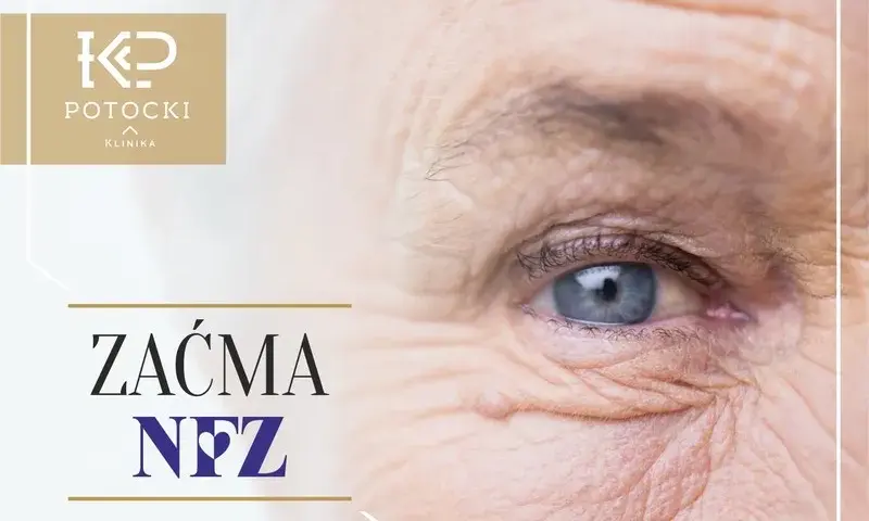 Zaćma: NFZ czy prywatnie? Gdzie najlepiej operować? Poradnik