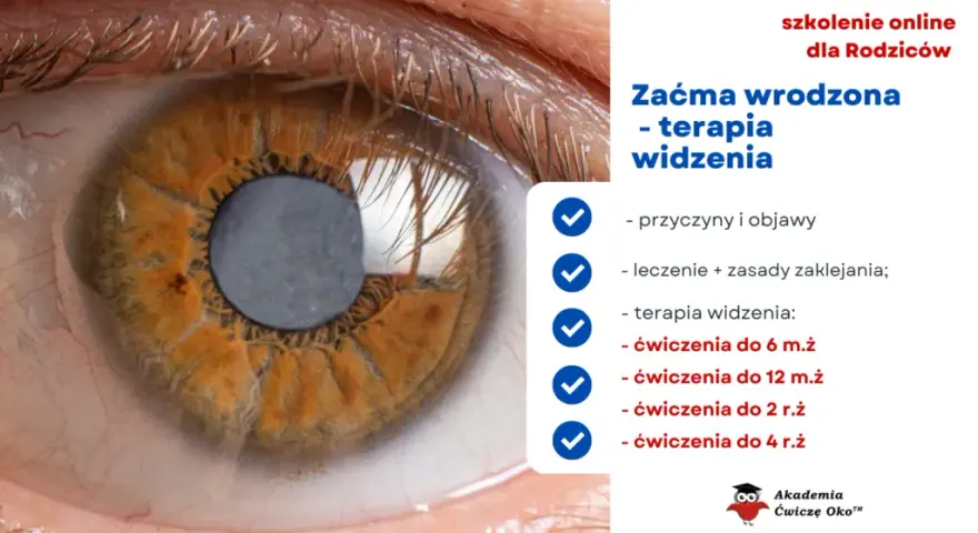 Zaćma wrodzona u dziecka: Objawy, diagnoza, leczenie ratuj wzrok!